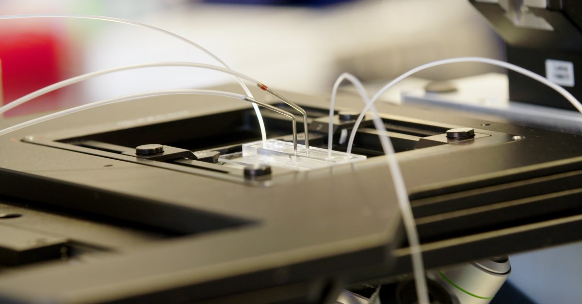 AI In Reproductive Medicine: A First Successful Pregnancy Reported AI In Reproductive Medicine: A First Successful Pregnancy Reported