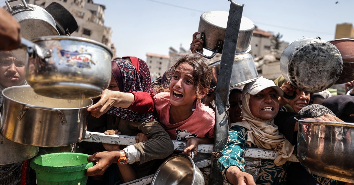 Post-Conflict Gaza: The Urgent Need To Address Chronic Malnutrition Post-Conflict Gaza: The Urgent Need To Address Chronic Malnutrition