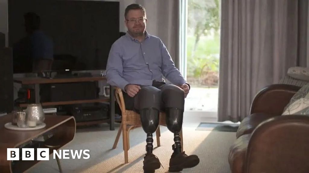 Surgeon Neil Hopper Sentenced For Self-Amputation Surgeon Neil Hopper Sentenced For Self-Amputation