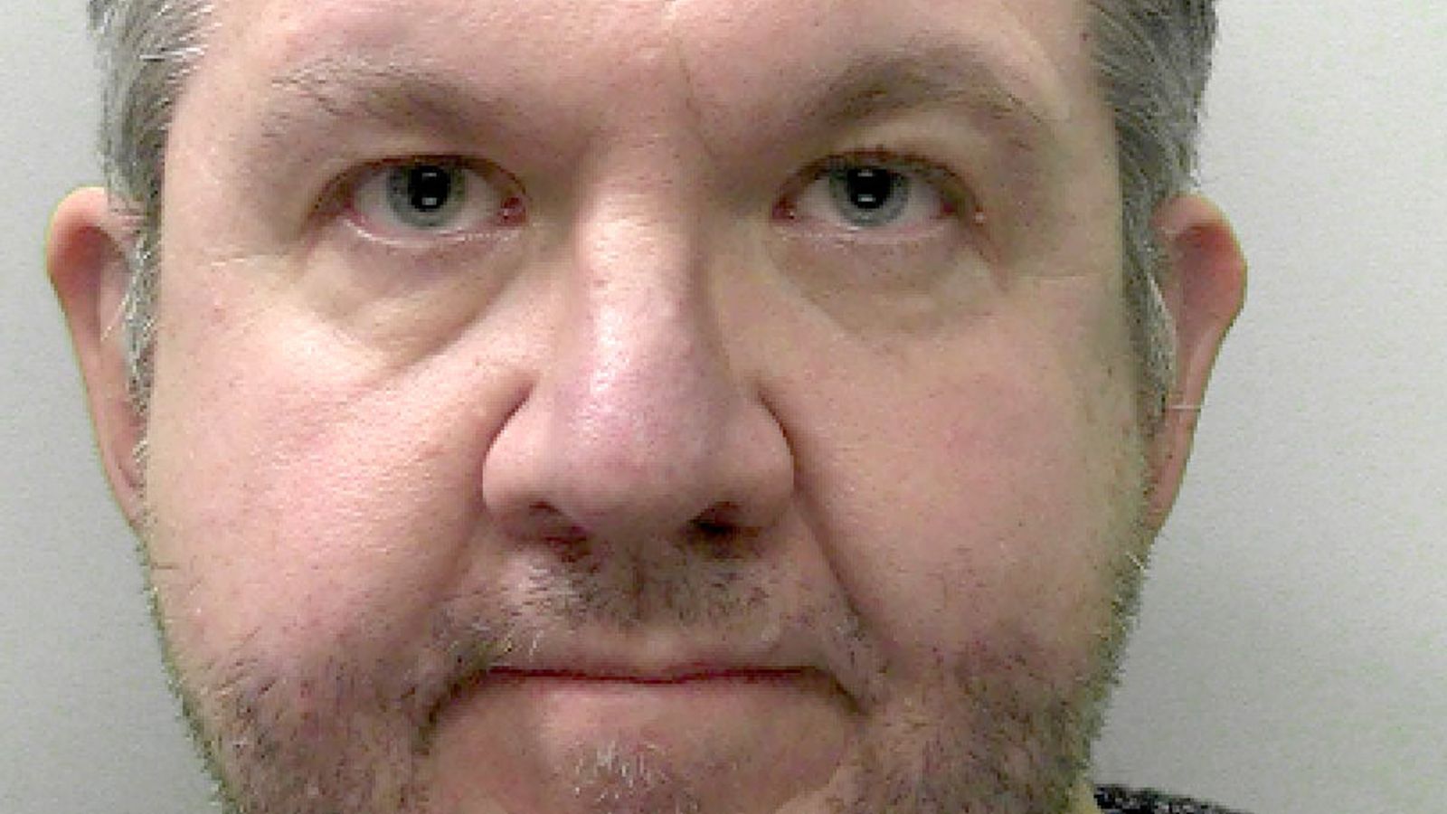 UK Surgeon's Conviction: Fraud And Leg Amputation For Sexual Reasons UK Surgeon's Conviction: Fraud And Leg Amputation For Sexual Reasons